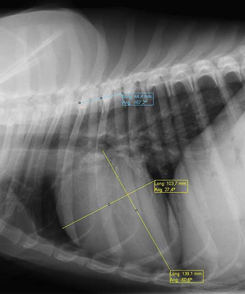 Radiographie